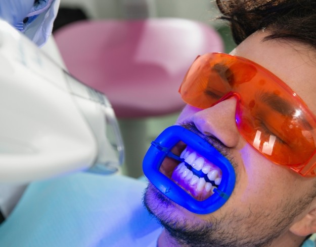 Male dental patient receiving in office teeth whitening