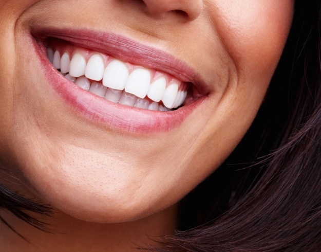 Close up of womans smile after a smile makeover