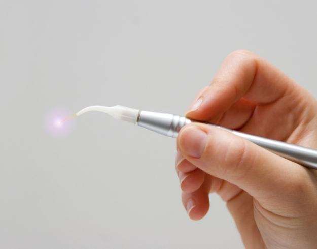 Hand holding a dental laser