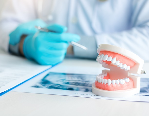 Model of teeth lying on X-ray in dentist's office