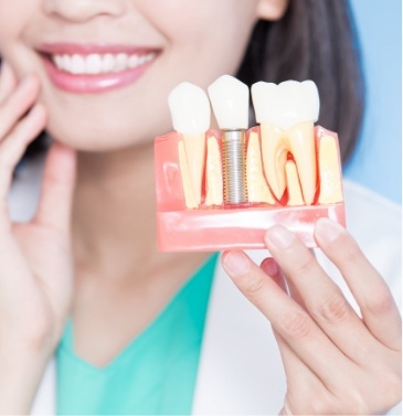 Dentist holding model of a dental implant