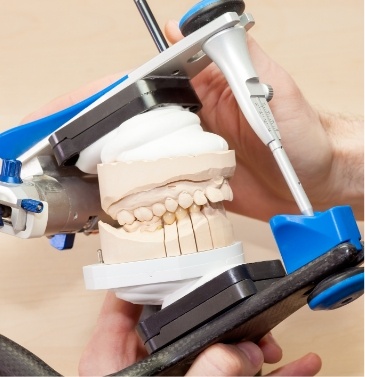 Model teeth being used to demonstrate equilibration